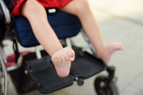 Disabled girl sitting in wheelchair. Close up photo of her legs spasticity muscles . Child cerebral palsy. Disability. Inclusion. photo