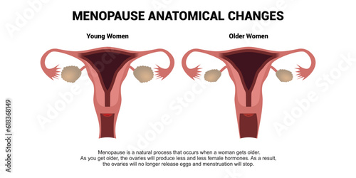 Menopause anatomical changes. Comparison of female reproductive system of young woman and older woman with explanations. Realistic anatomy vector illustration