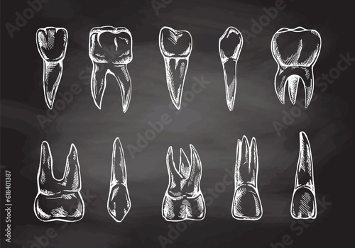 Stomatology hand drawn set. Toothache treatment. Teeth sketch.  Different types of human tooth.  Engraving fangs and molars isolated on chalkboard background.