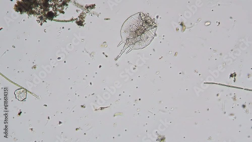 Rotifer movement in fresh water followed by camera. Optical microscope with objective 10x