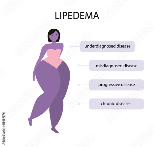  Woman suffering with lipedema disease concept photo