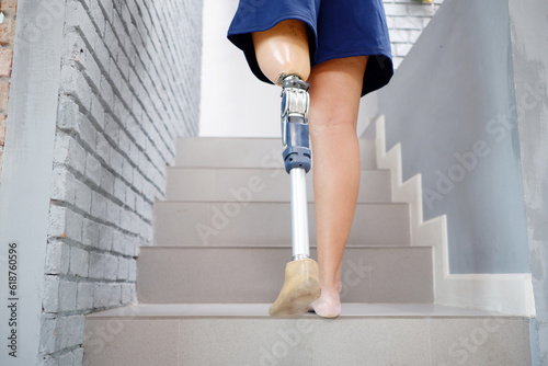 Disabled woman wearing prosthetic legs Prosthetic legs.