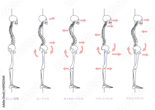 横から見た不良姿勢の骨格セット