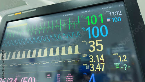 Hospital monitor displaying vital signs: heart rate, blood pressure, pulse oximetry, temperature. Symbolizing health monitoring and medical care photo