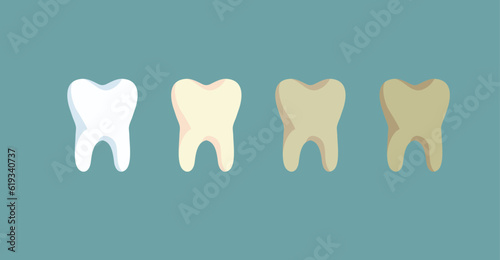 Teeth Coloring from White to Dark Concept Vector Illustration. Denture bleaching professionally by dental hygienist with incredible results 
