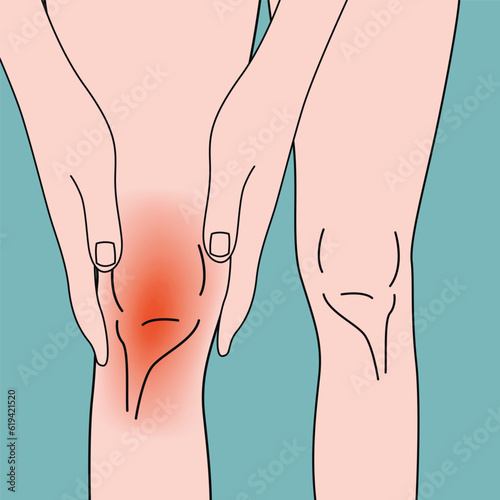 Inflamed knee. The girl holds her hands on her leg. Medical poster. Vector illustration