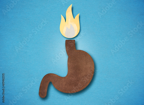 Photos Heartburn or Pyrosis - GERD - Conceptual Illustration