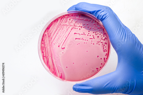 Close up of gloved hand holds petri dish with Escherichia coli colonies on MacConkey agar photo