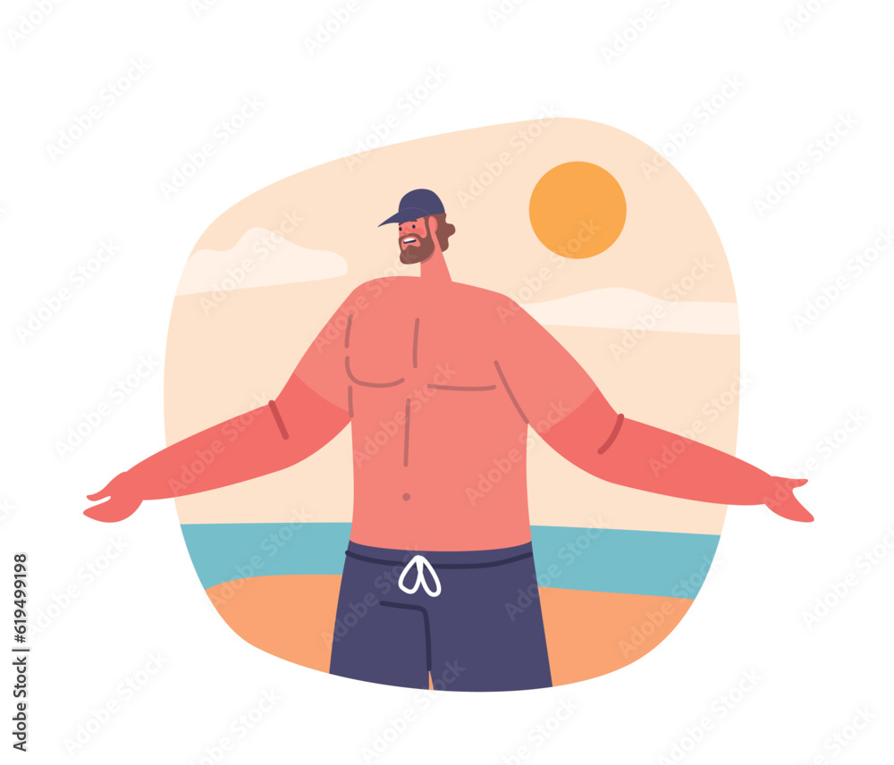 Man With Sunburned Hands, Red And Peeling From Prolonged Sun Exposure. A Painful Reminder Of The Importance Man With Sunburned Hands, Red And Peeling From Prolonged Sun Exposure. A Painful Reminder Of The Importance