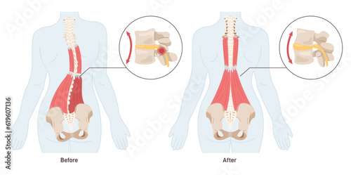 Massage effect. Back pain treatment and muscles relaxation. Spasmed