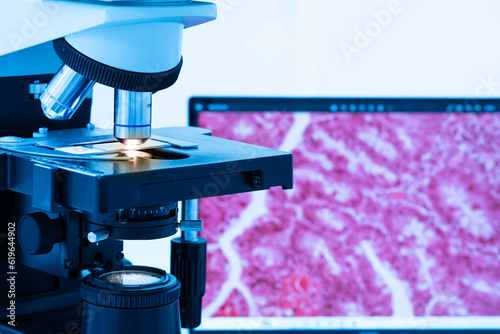 Modern microscope and human tissue section slide with computer monitor show glandular image.Medical patholology and cytology technology concept.Selective focus. photo