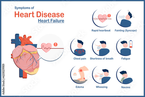 Medical illustration concept, symptoms of heart disease caused by heart failure.Fatigue,rapid heartbeat, nausea and vomiting,wheezing,swelling in the legs or ankles,chest pain and syncope, flat style.
