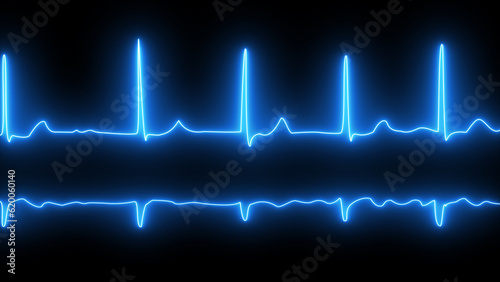ECG or EKG pulse heartbeat blue line symbol on black background. fibrillation. ECG with brief paroxysms of supraventricular extrasystole and neon atrial fibrillation. photo