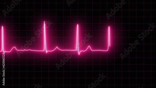 neon Atrial fibrillation ECG loop animation. ECG with supraventricular premature beats and short paroxysms of neon atrial fibrillation animation. Loop EKG Heart Rate In Normal Sinus Rhythm photo
