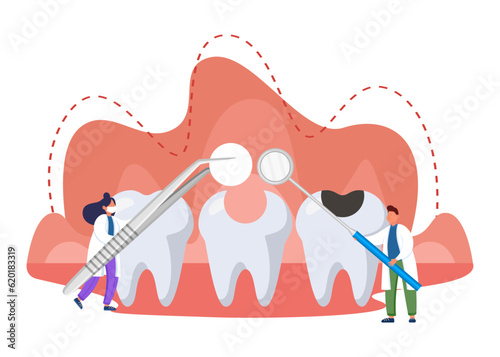 Tiny dentists filling tooth vector illustration. Doctors treating tooth cavity and root canals, using dental equipment in mouth. Dental procedures, health care concept