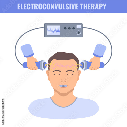 Electroconvulsive therapy for severe depression and schizophrenia treatment. ECT electrodes placement on a male patient. Brain stimulation equipment for major depressive disorders. Vector illustration