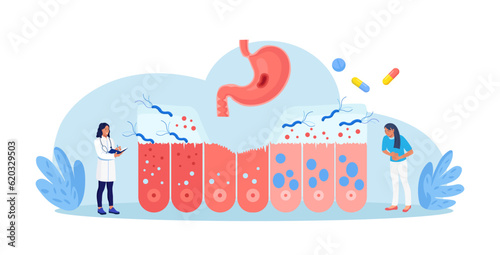 Helicobacter pylori infection. Bacterium with flagella damage stomach tissue. Digestive tract diseases, gastritis. Doctor inspecting stomach, intestine microflora, gut microorganisms. Gastroenterology