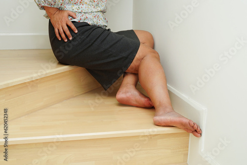 Fototapeta Asian lady woman injuries from falling down on slippery surfaces stairs in living room at home