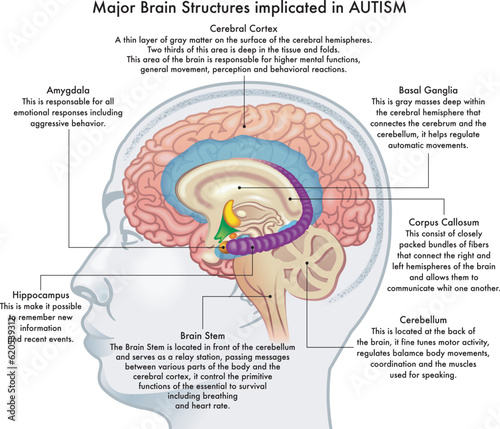 Medical illustration showing major brain structures implicated in autism spectrum disorder, with annotations.