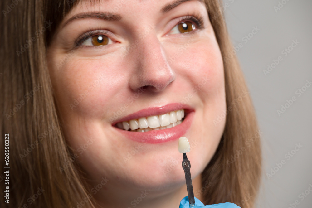 Close-up of dentist's hand using shade guide at woman's mouth to check veneer of teeth for bleaching Close-up of dentist's hand using shade guide at woman's mouth to check veneer of teeth for bleaching