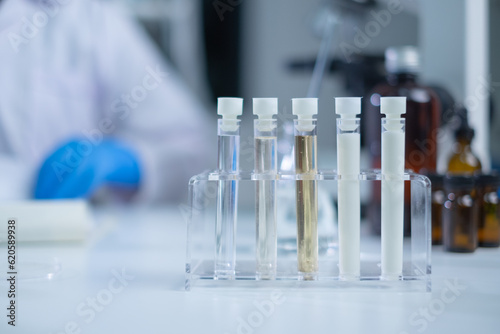 Test tube with a sample of milk. Concept of nutrition, lactose, protein, bacteria, fat and glucose laboratory. Dairy milk test. Nutritionist is checking and analyze the quality of factory milk product