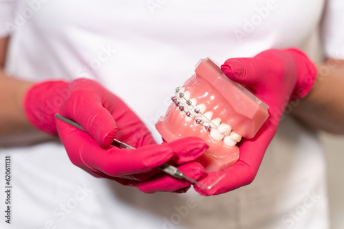 Fototapeta Naklejka Na Ścianę i Meble -  Close-up dentist hands in medical gloves hold plaster human jaw layout using plugger, describe therapy to patient. Oral hygiene orthodontic treatment