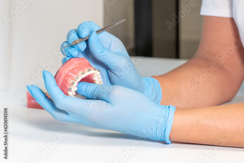 Close-up dentist hands in medical gloves hold plaster human jaw layout using plugger, describe therapy to patient. Oral hygiene orthodontic treatment photo