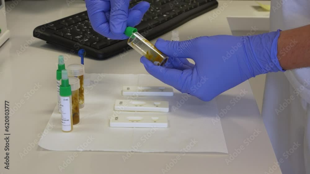 Laboratory assistant swapping human stool samples with a small rod and mixing the feces to prepare samples for testing on blood with rapid test cassette in small laboratory in clinic