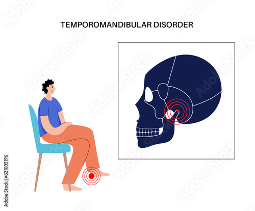 TMD TMJ disorder