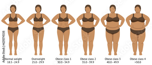 Female figures with normal weight, overweight and obesity photo