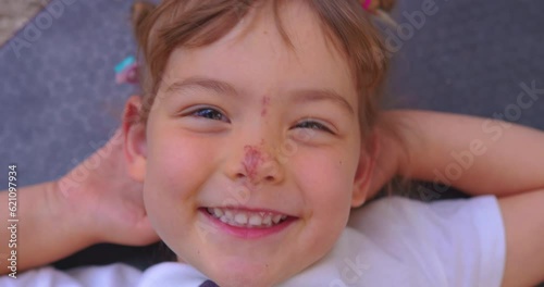 Portrait of a small child of three years old with an abrasion on his face. Close-up of a little girl with a wound on her nose. Scratched baby face. Domestic violence against a child