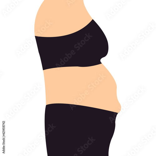Woman belly Tummy Tuck flabby skin Female Body Abdomen. Alcohol Hormonal Stressed Mommy Apron Sagging protruding superficial tummy Demonstrating Liposuction. Diet Weight Loss Fat Belly slim stomach