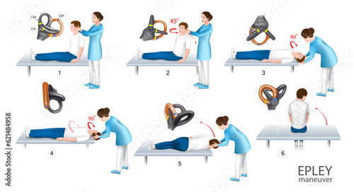 Epley maneuver is performed help of a doctor photo