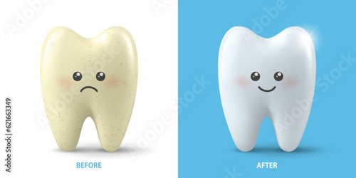 Vector Banner with Realistic Sad and Happy Tooth. Cleaning Concept - Before, After Hygienic Teeth Cleaning. Dentistry Design. Medical, Toothpaste Advertisement. Healthy Oral Hygiene, Teeth Whitening