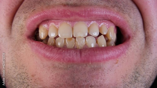 Close up while grinding slightly yellowish adult male teeth with some missing teeth and or spaces in back.