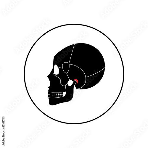 TMD TMJ disorder
