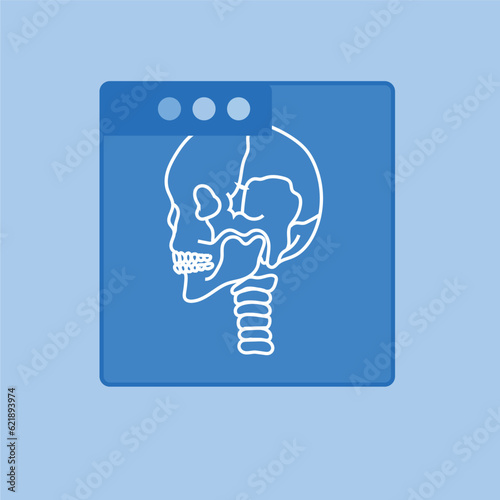 CT scan skeleton
