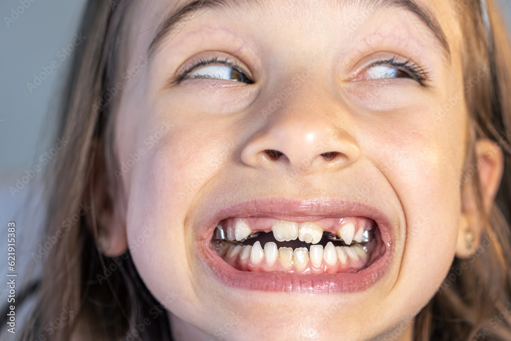 Child during orthodontist visit and oral cavity check-up. Child during orthodontist visit and oral cavity check-up.