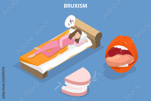 3D Isometric Flat Vector Conceptual Illustration of Bruxism, Teeth Grinding