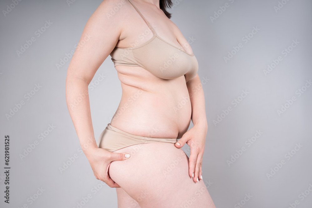 Overweight woman with fat hips and flabby belly, obesity female body