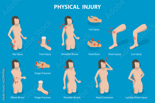 3D Isometric Flat Vector Conceptual Illustration of Physical Injuries, Human Injury Accidents
