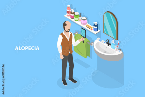 3D Isometric Flat Vector Conceptual Illustration of Baldness Alopecia, Hairloss Problem