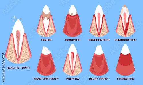 Dog tooth disease problem. Canine dental anatomy gum, root, teeth. Inflammation banner. Vector illustration for vet clinic, healthcare, education