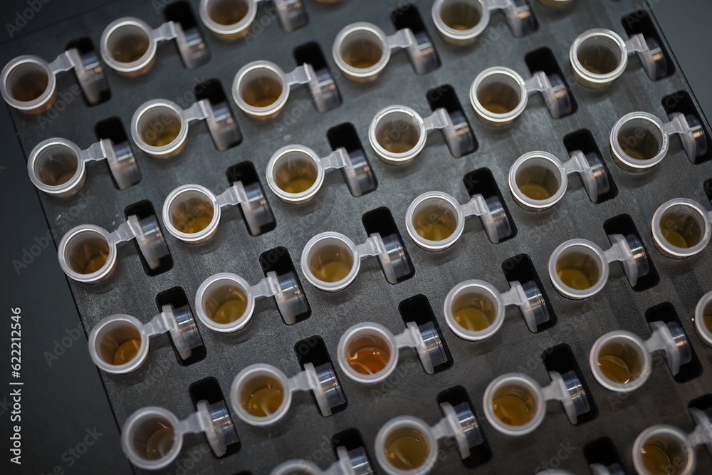 Human Biological Specimens storage place. Human Biological Specimens storage place.
