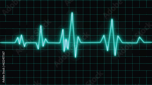 Fotografia Electrocardiogram show pulse rate graph ,Heart beat ,ECG ,EKG  interpretation ,Vital sign ,Life line ,Medical healthcare symbol