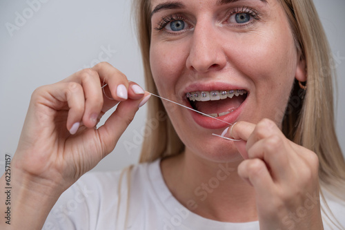 Caucasian woman cleaning her teeth with braces using dental floss. 