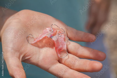 orthodontic plate for correcting an overbite on a boy's hand. close-up photo