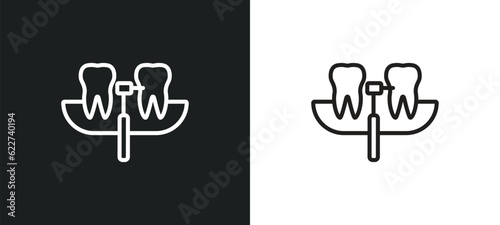 interproximal outline icon in white and black colors. interproximal flat vector icon from dentist collection for web, mobile apps and ui.