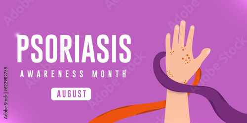 Psoriasis awareness month concept. Men's hand surroundings are orange and purple color ribbons. Horizontal vector poster design.