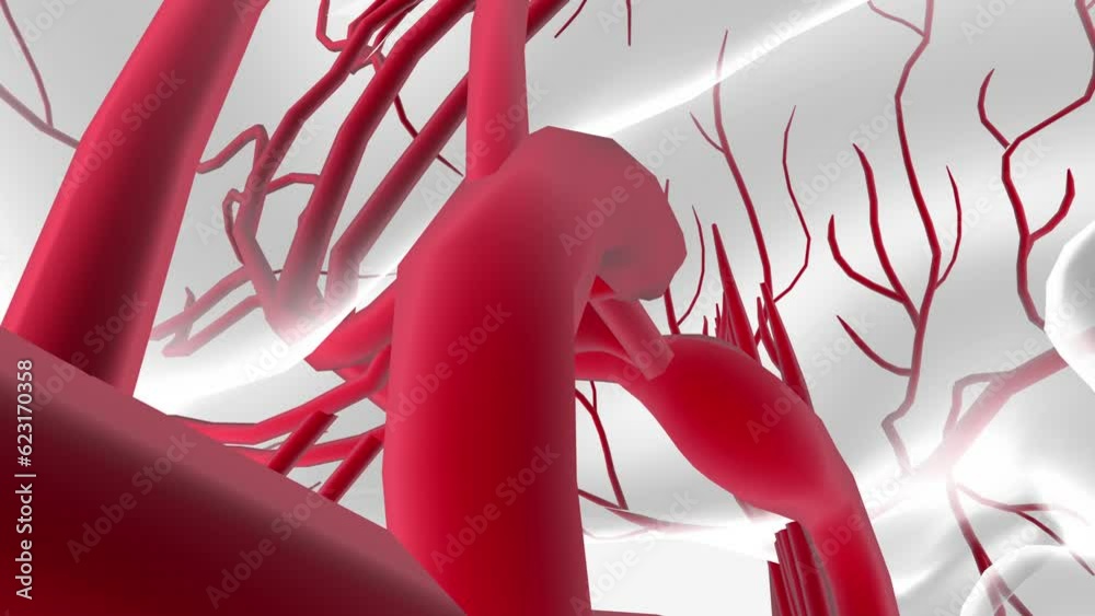 cerebral aneurysm is a weak or thin spot on an artery in the brain that